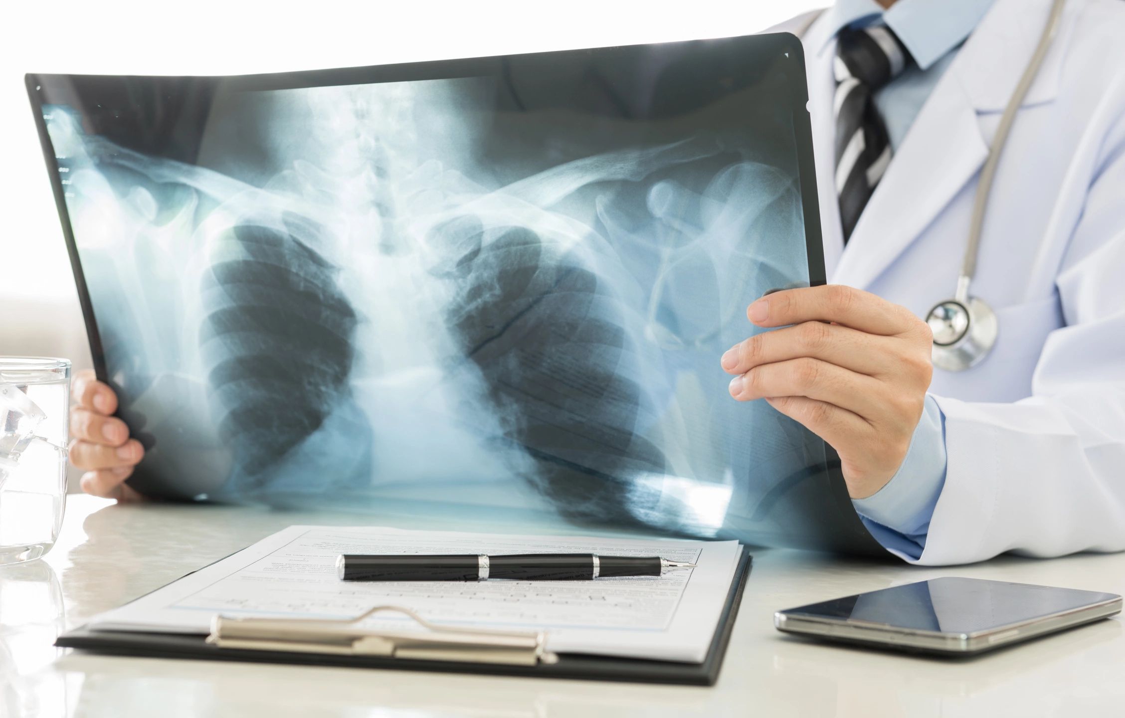 Person sitting at a desk, with clipboard and pend, holding a chest X-ray,